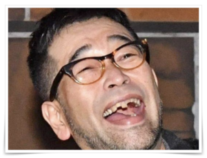 槇原敬之 逮捕前 激ヤセ 歯がボロボロ 画像