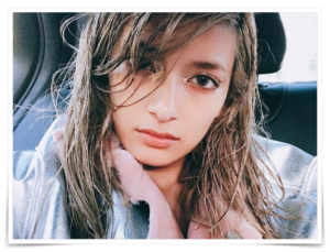 ローラ 唇 ヒアルロン酸 卒アル 画像 写真 昔