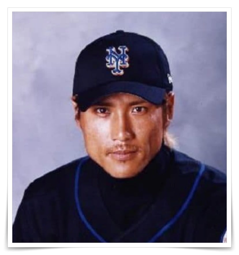 新庄剛志の整形画像